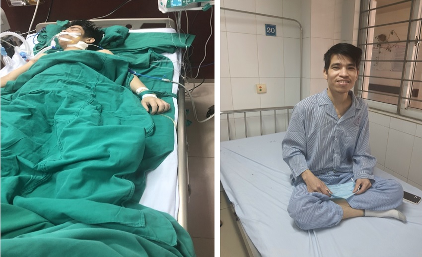 MỔ CẤP CỨU THÀNH CÔNG 1179king com BỊ SỐC MẤT MÁU NẶNG DO U GAN VỠ