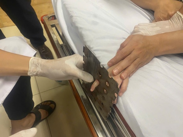 CẢNH BÁO TAI NẠN KẸT TAY Ở TRẺ NHỎ:  ĐỪNG CHỦ QUAN CHỈ VÌ MỘT PHÚT KHÔNG ĐỂ Ý